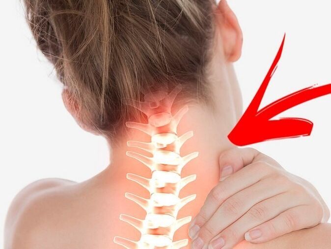 Kompresija živčanih korijena s cervikalnom osteohondrozom