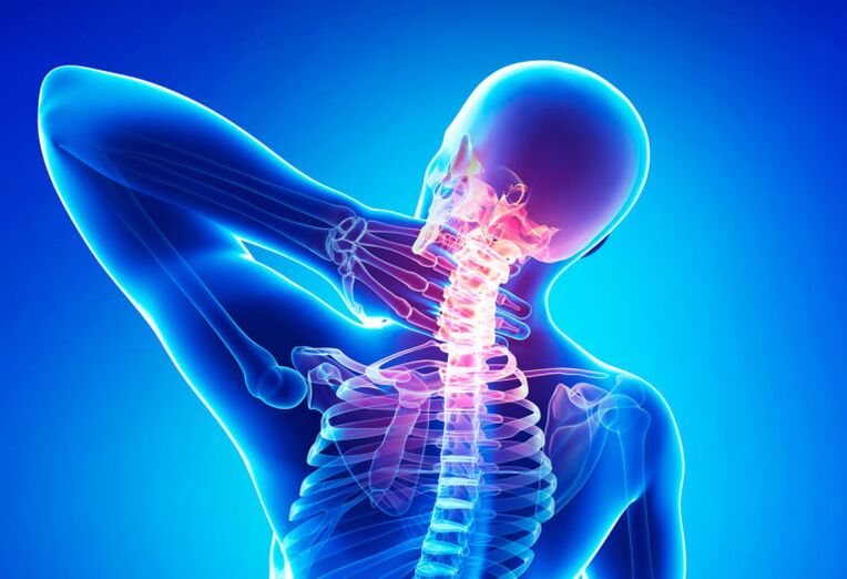 Osteohondroza grlića maternice