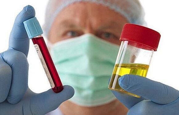 Načini dijagnosticiranja osteohondroze kralježnice grlića maternice