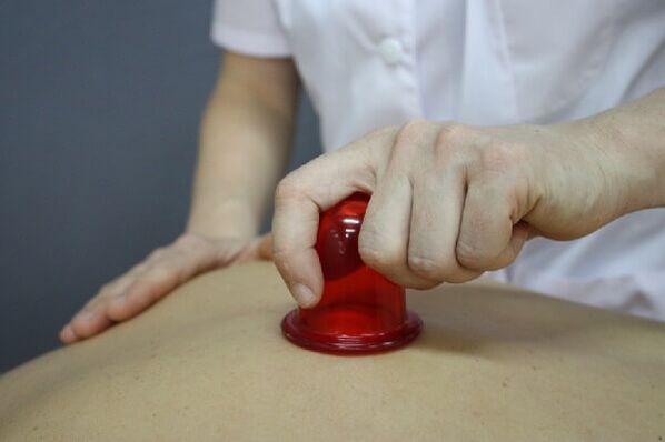Cupping masaža za osteohondrozu kralježnice